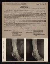 Lower Limb. Front of Leg - no. 1