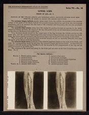 Lower Limb. Front of Leg - no. 2