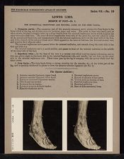 Lower Limb. Dorsum of Foot - no. 1