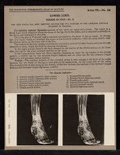 Lower Limb. Dorsum of Foot - no. 2