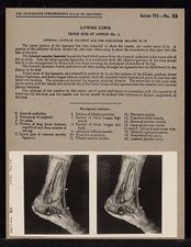 Lower Limb. Inner Side of Ankle - no. 1