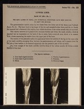 Lower Limb. Back of Leg - no. 1