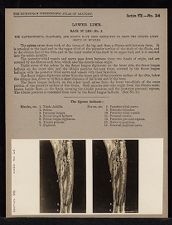 Lower Limb. Back of Leg - no. 2