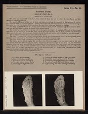 Lower Limb. Sole of Foot - no. 1