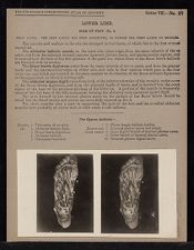 Lower Limb. Sole of Foot - no. 2