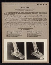 Lower Limb. Articulations. Ankle and Foot - no. 1