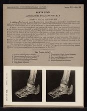 Lower Limb. Articulations. Ankle and Foot - no. 2