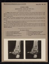 Lower Limb. Articulations. Ankle and Foot - no. 3