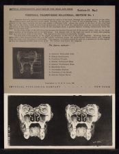 Vertical Transverse Bilateral Section - no. 1