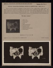 Vertical Transverse Bilateral Section as shown in nos. 1 and 2 - no. 3