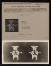 Vertical Transverse Bilateral Section - no. 4