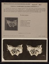 Vertical Transverse Bilateral Section - no. 5