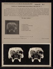 Vertical Transverse Bilateral Section - no. 7