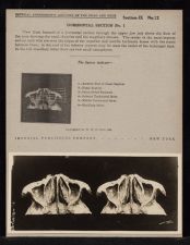 Horizontal Section - no. 1
