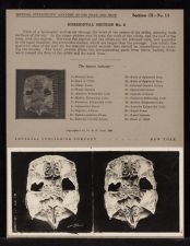 Horizontal Section - no. 2