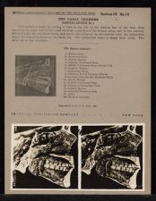 The Nasal Chamber Sagittal Section - no. 1