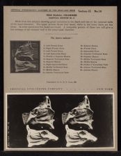 The Nasal Chamber Sagittal Section - no. 2