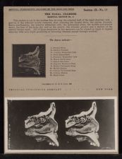 The Nasal Chamber Sagittal Section - no. 3