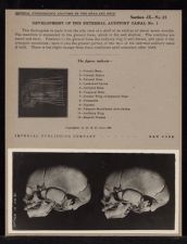 Development of the External Auditory Canal - no. 1