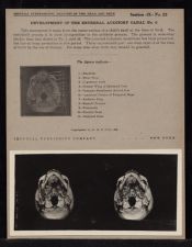 Development of the External Auditory Canal - no. 2