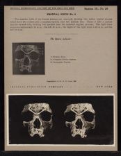 Frontal Sinus - no. 3