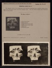 Frontal Sinus - no. 4