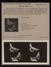 Frontal Sinus - no. 13