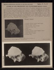 Course of the Descending and Transverse Facial Canal