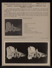 Vertical Transverse Section Through Tympanum and Mastoid Process