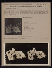 Relation of Ossicles to Vestibule of Cochlea