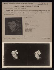 Ossicular Relation to Tympanum