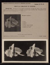 Ossicular Relation to Cochlea