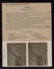 Abdomen. Abdominal Wall - no. 1