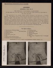 Abdomen. Abdominal Wall - no. 2