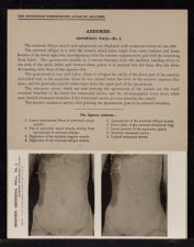 Abdomen. Abdominal Wall - no. 3