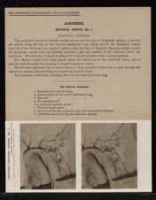 Abdomen. Inguinal Region - no. 1