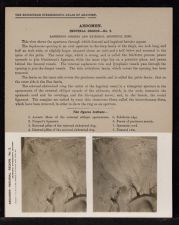 Abdomen. Inguinal Region - no. 2