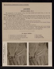 Abdomen. Inguinal Region - no. 3