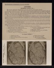 Abdomen. Abdominal Cavity - no. 1