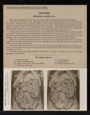 Abdomen. Abdominal Cavity - no. 2