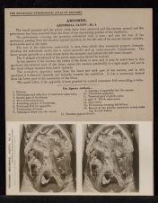 Abdomen. Abdominal Cavity - no. 4