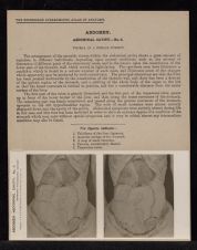 Abdomen. Abdominal Cavity - no. 5