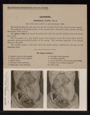 Abdomen. Abdominal Cavity - no. 6