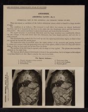 Abdomen. Abdominal Cavity - no. 8