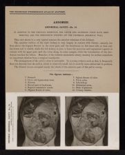 Abdomen. Abdominal Cavity - no. 10