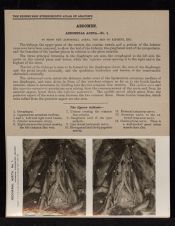 Abdomen. Abdominal Aorta - no. 1