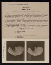 Abdomen. Viscera - no. 3