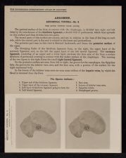 Abdomen. Abdominal Viscera - no. 9