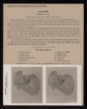 Abdomen. Viscera - no. 10