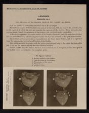 Abdomen. Bladder - no. 1